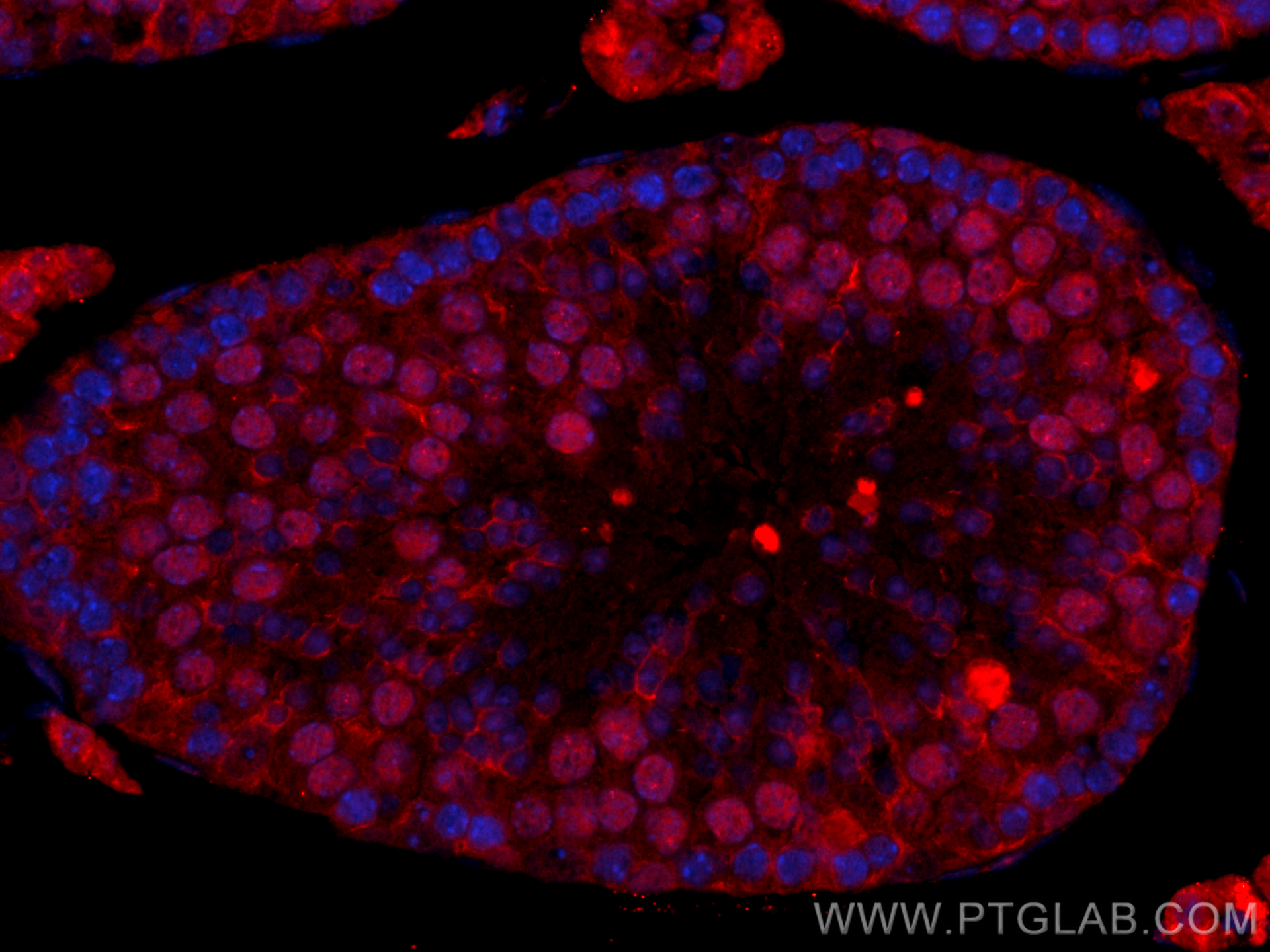 IF Staining of mouse testis using CL594-15073