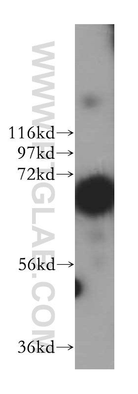 WB analysis of MCF-7 using 17718-1-AP