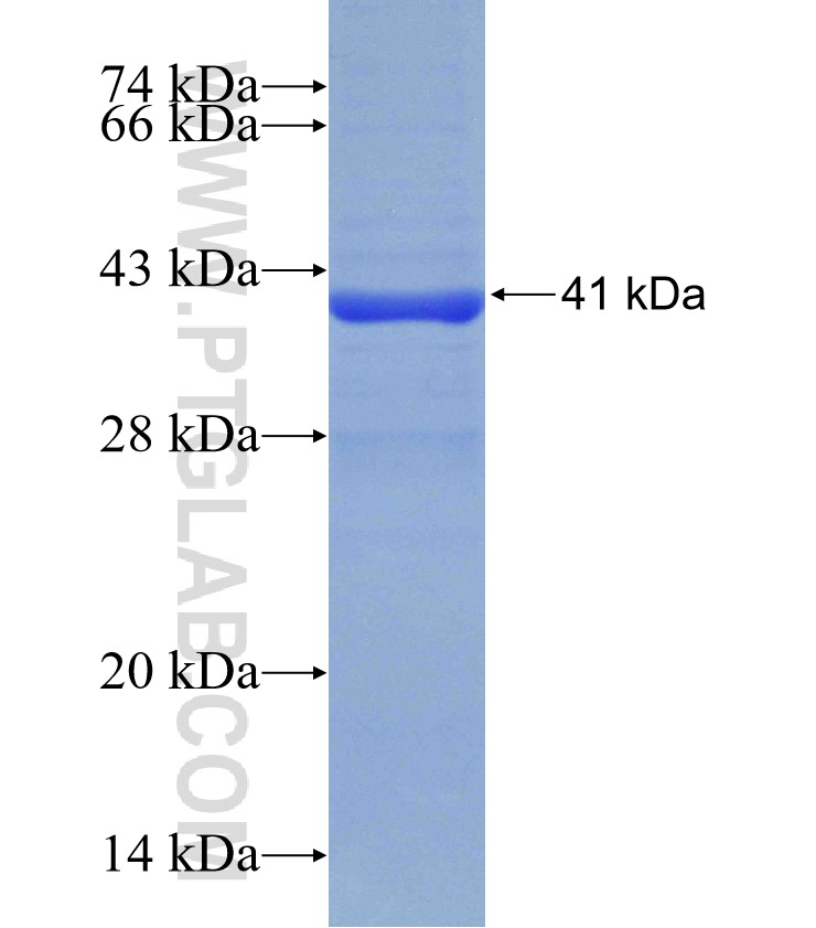 METTL4 fusion protein Ag31131 SDS-PAGE