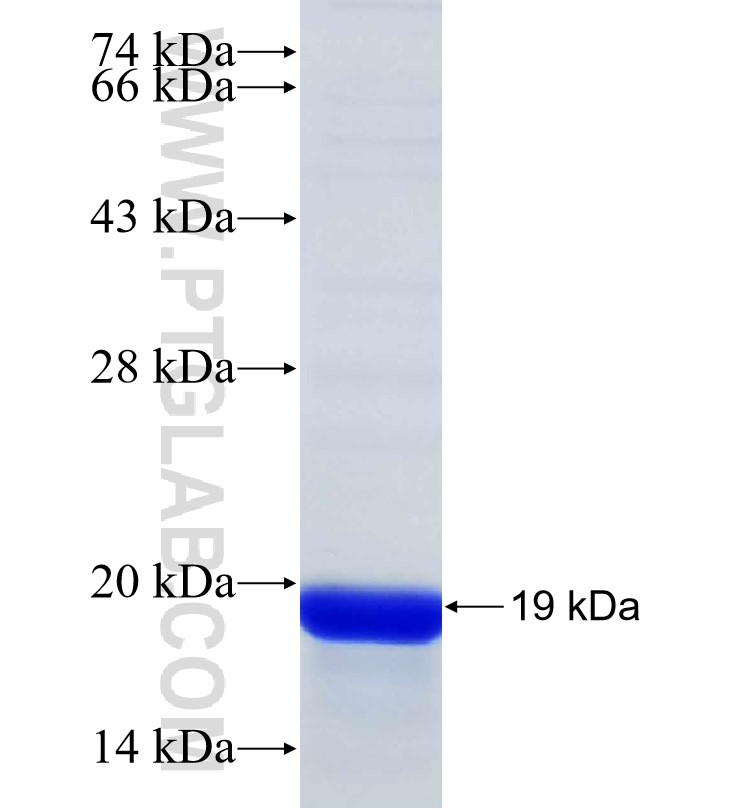 METTL4 fusion protein Ag31154 SDS-PAGE