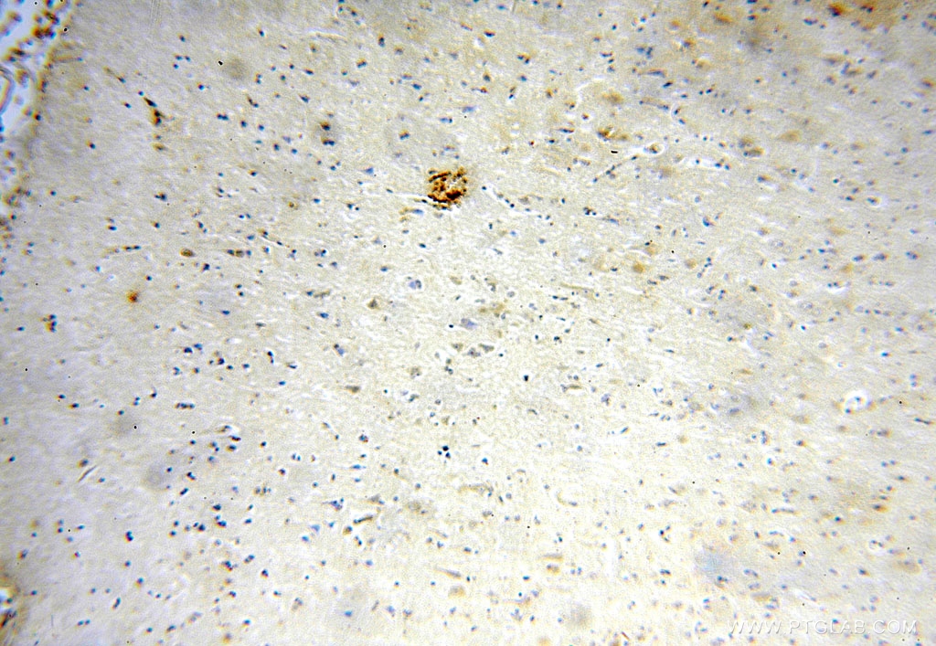 IHC staining of human brain using 16791-1-AP