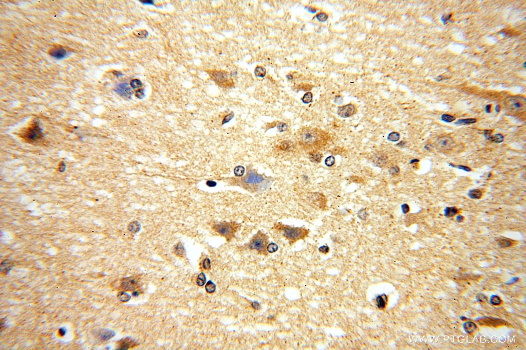 IHC staining of human brain using 16791-1-AP