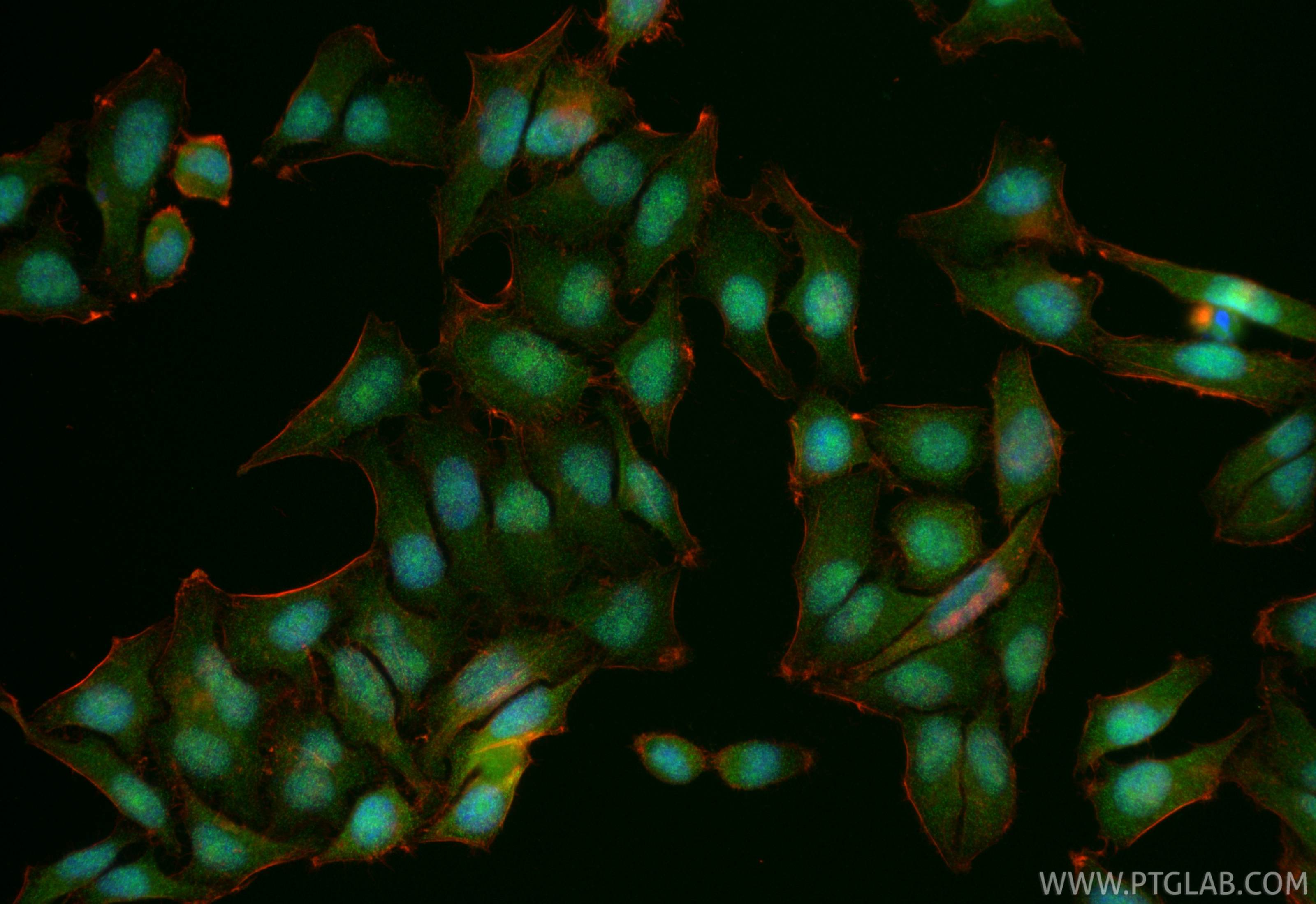 IF Staining of HepG2 using RMX00070