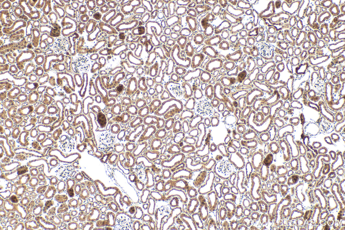 IHC staining of mouse kidney using RMX00070