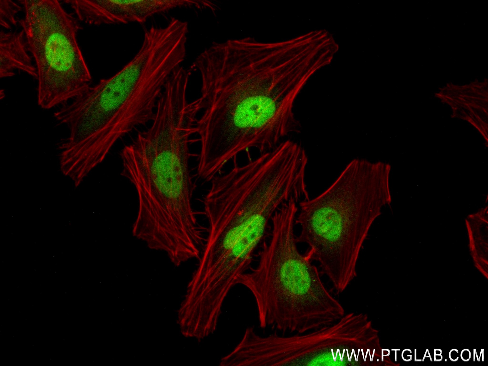IF Staining of HeLa using 84209-5-RR