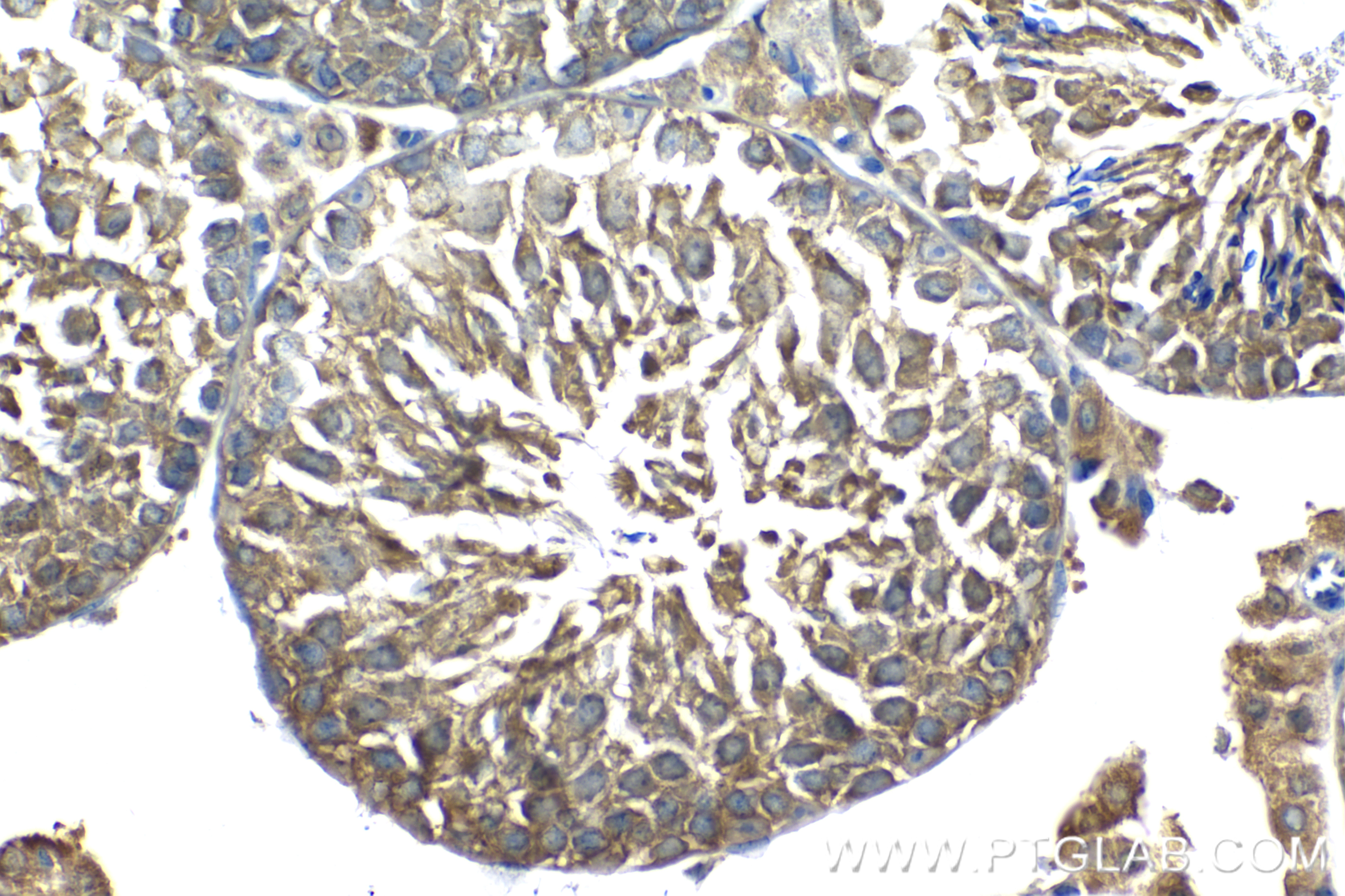 IHC staining of mouse testis using 84209-5-RR (same clone as 84209-5-PBS)