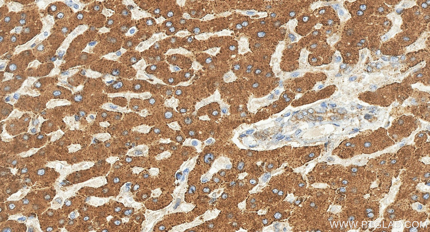 IHC staining of human liver using 17092-1-AP IHC staining of human liver using 17092-1-AP