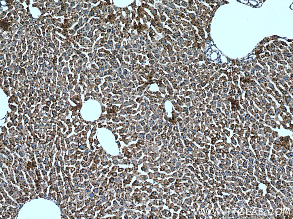 IHC staining of mouse liver using 17001-1-AP