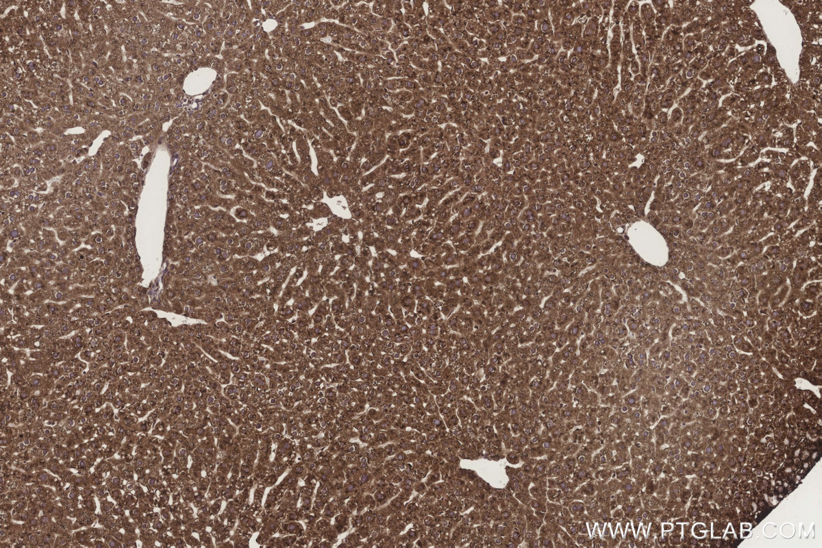 IHC staining of mouse liver using 17001-1-AP IHC staining of mouse liver using 17001-1-AP