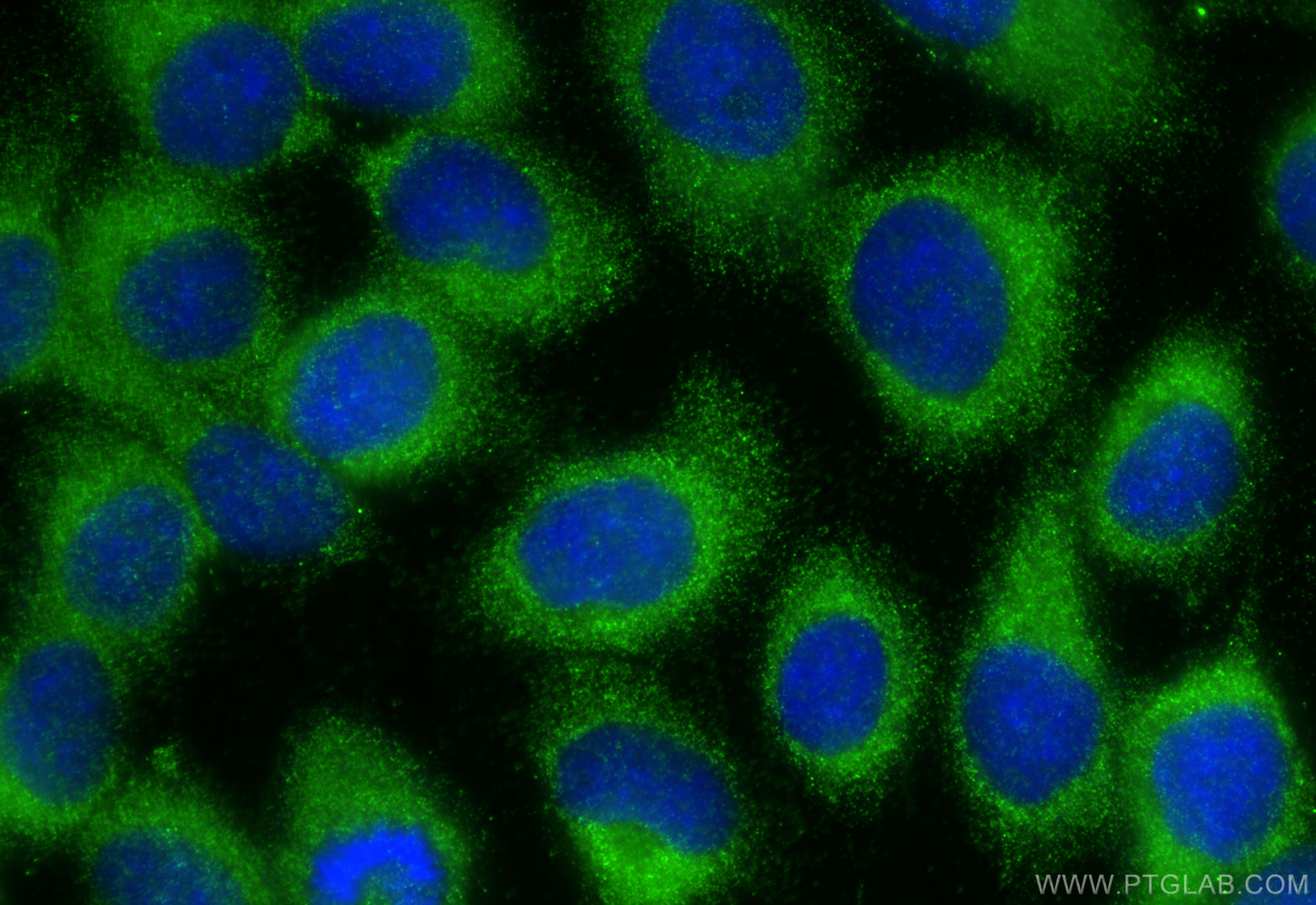 IF Staining of A431 using 31173-1-AP