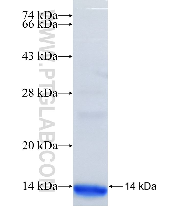 METTL8 fusion protein Ag36748 SDS-PAGE METTL8 fusion protein Ag36748 SDS-PAGE