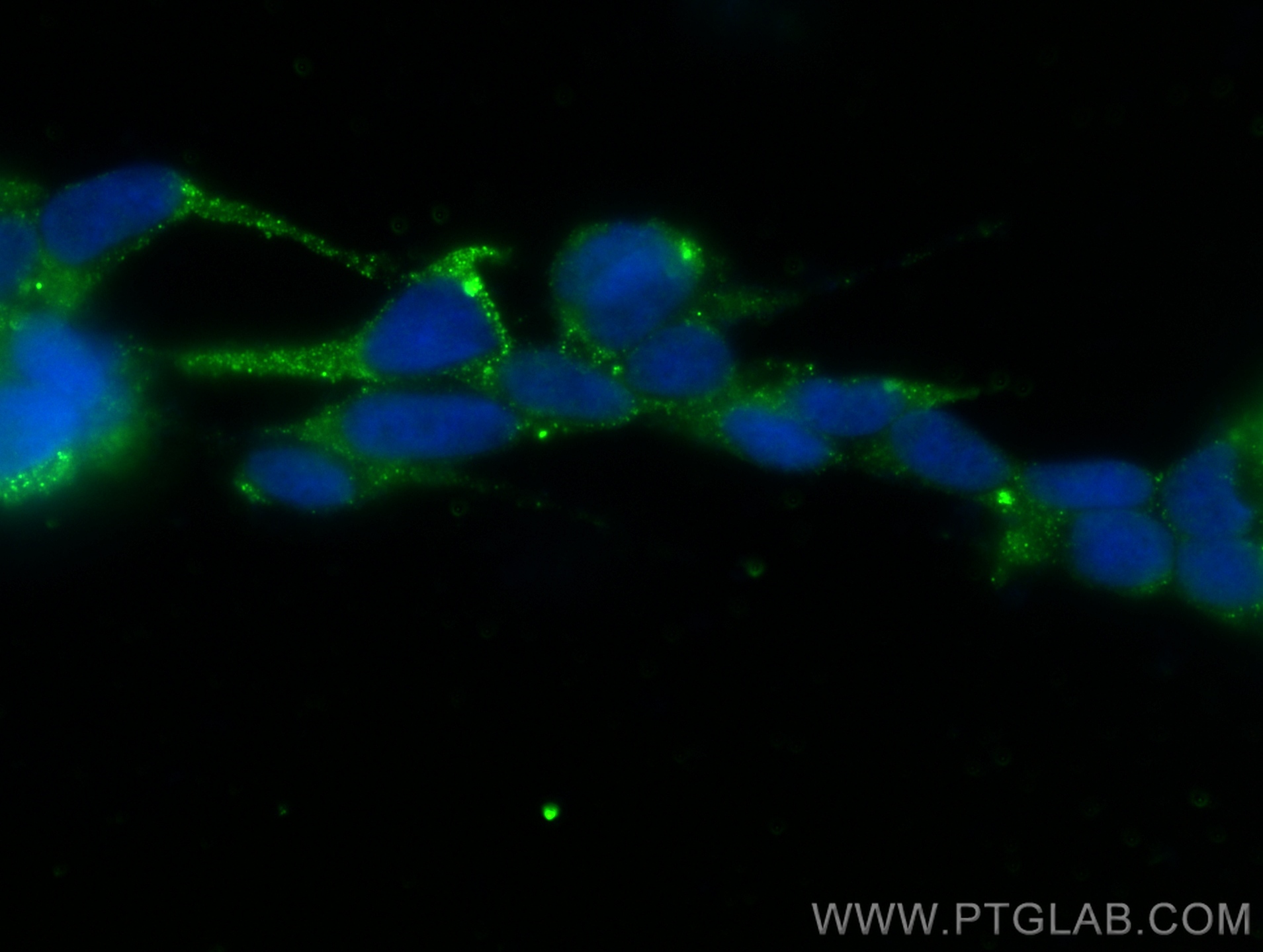 IF Staining of SH-SY5Y using 30865-1-AP