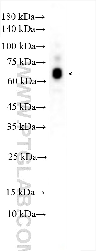 WB analysis of SGC-7901 using 30185-1-AP
