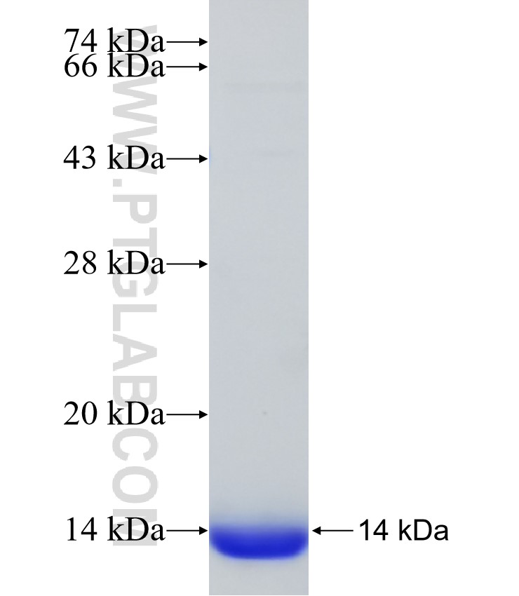 MEX3B fusion protein Ag30738 SDS-PAGE MEX3B fusion protein Ag30738 SDS-PAGE