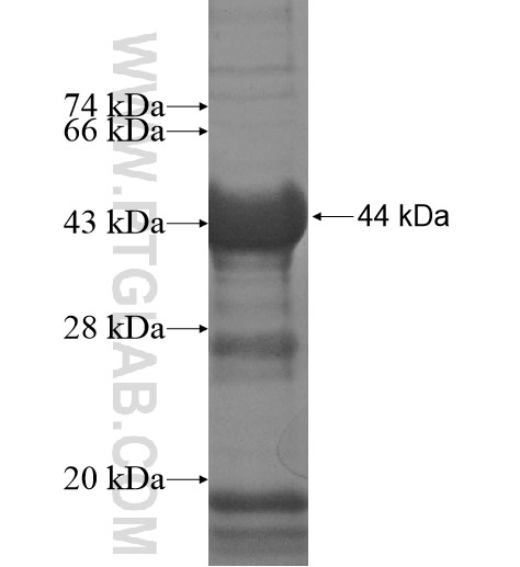 MEX3B fusion protein Ag12156 SDS-PAGE MEX3B fusion protein Ag12156 SDS-PAGE