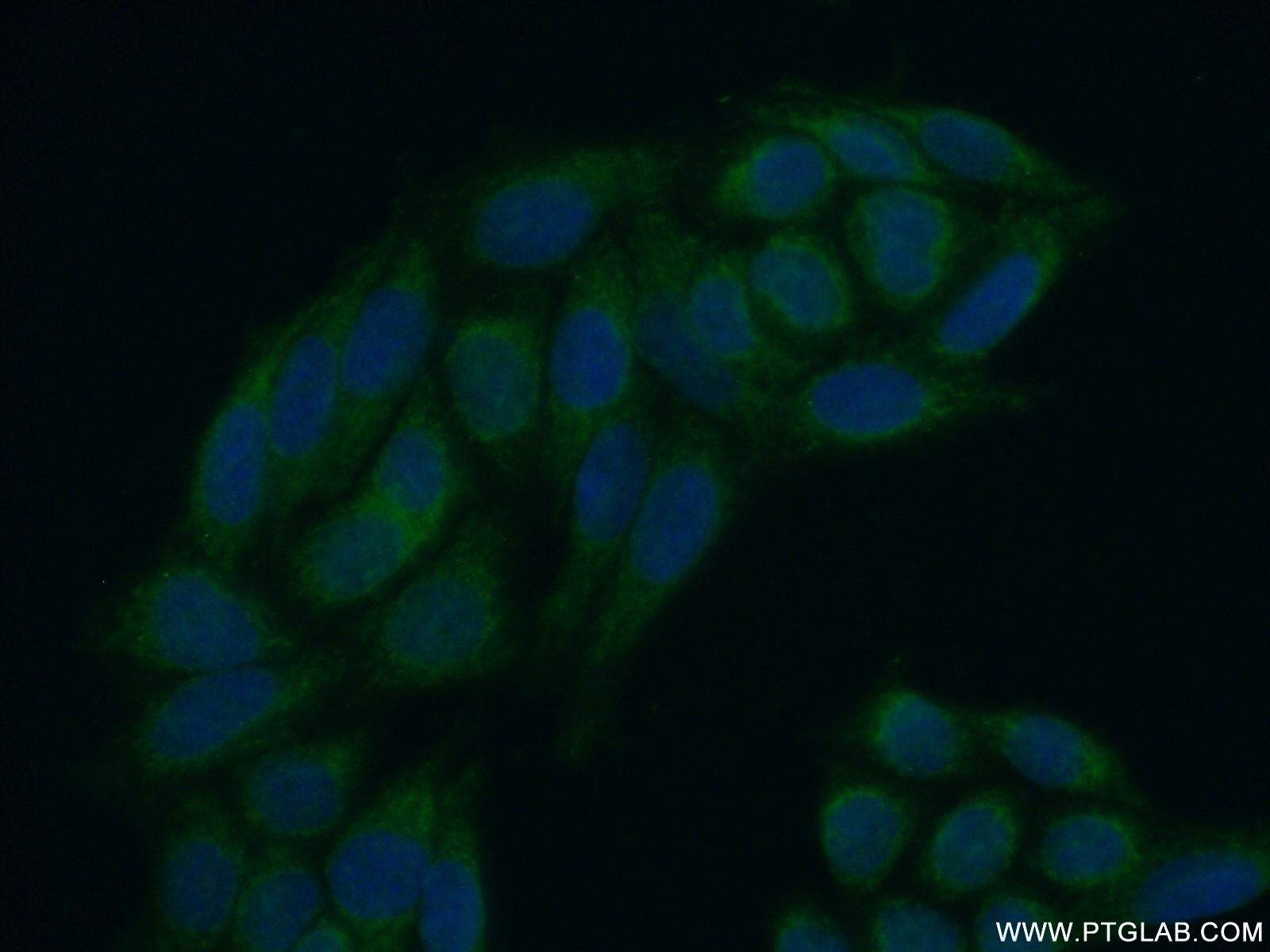 IF Staining of HeLa using 22882-1-AP