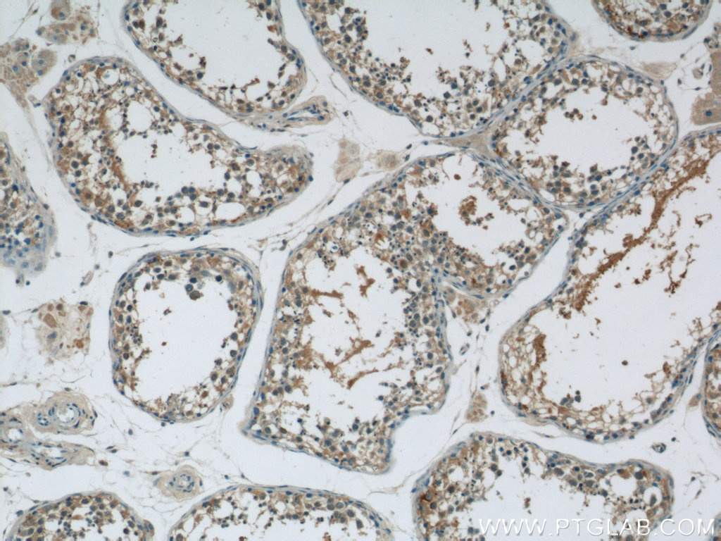 IHC staining of human testis using 22882-1-AP