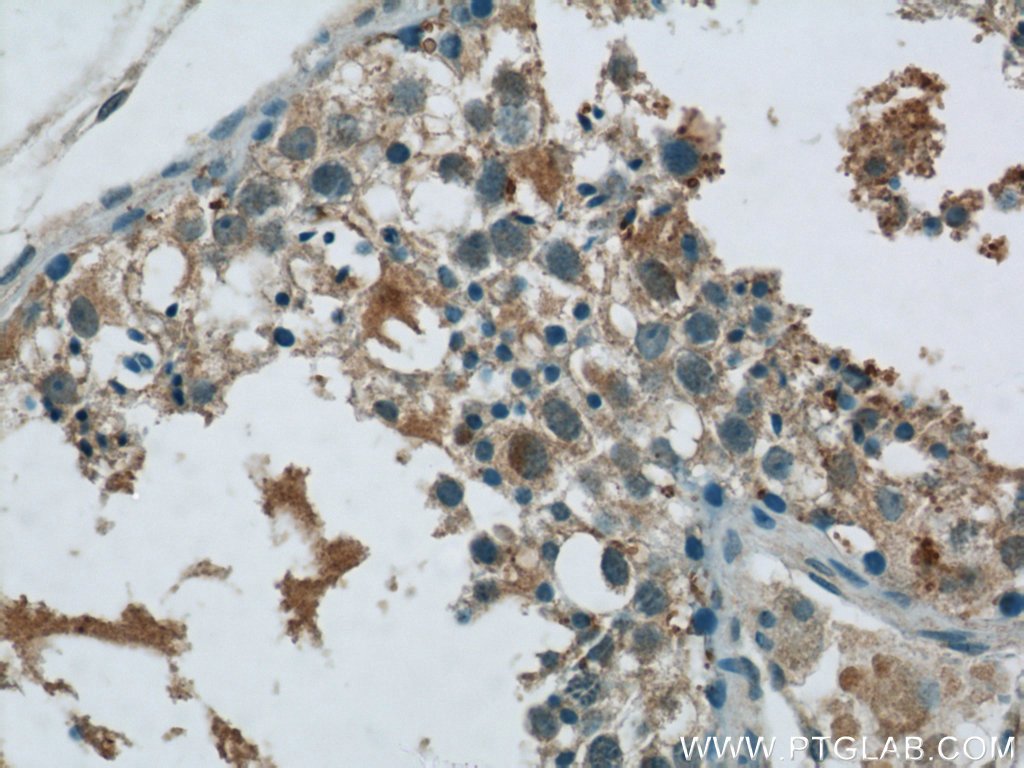 IHC staining of human testis using 22882-1-AP