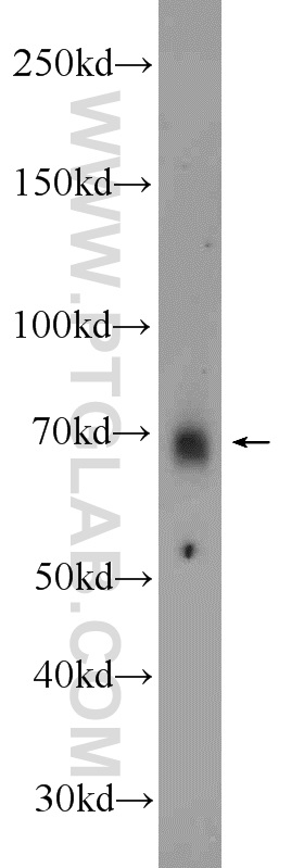 WB analysis of HeLa using 22882-1-AP