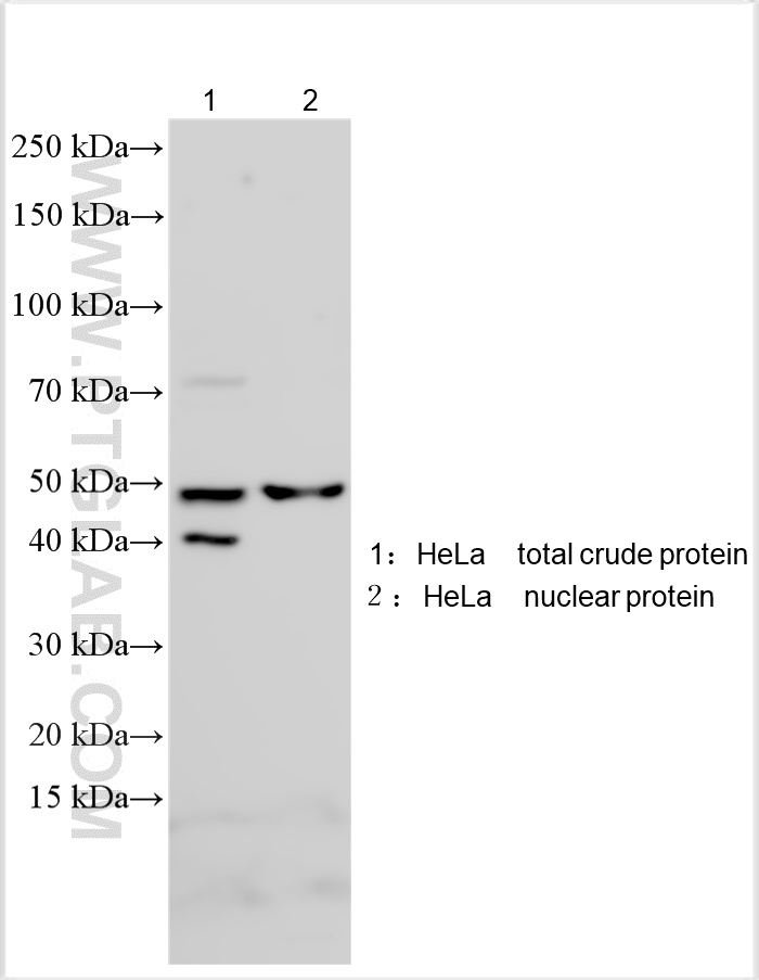 Various lysates were subjected to SDS PAGE followed by western blot with 33188-1-AP (MFAP3L antibody) at dilution of 1:1500 incubated at room temperature for 1.5 hours. WB analysis using 33188-1-AP