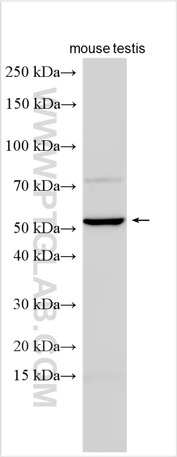 Various lysates were subjected to SDS PAGE followed by western blot with 33188-1-AP (MFAP3L antibody) at dilution of 1:1500 incubated at room temperature for 1.5 hours. WB analysis using 33188-1-AP