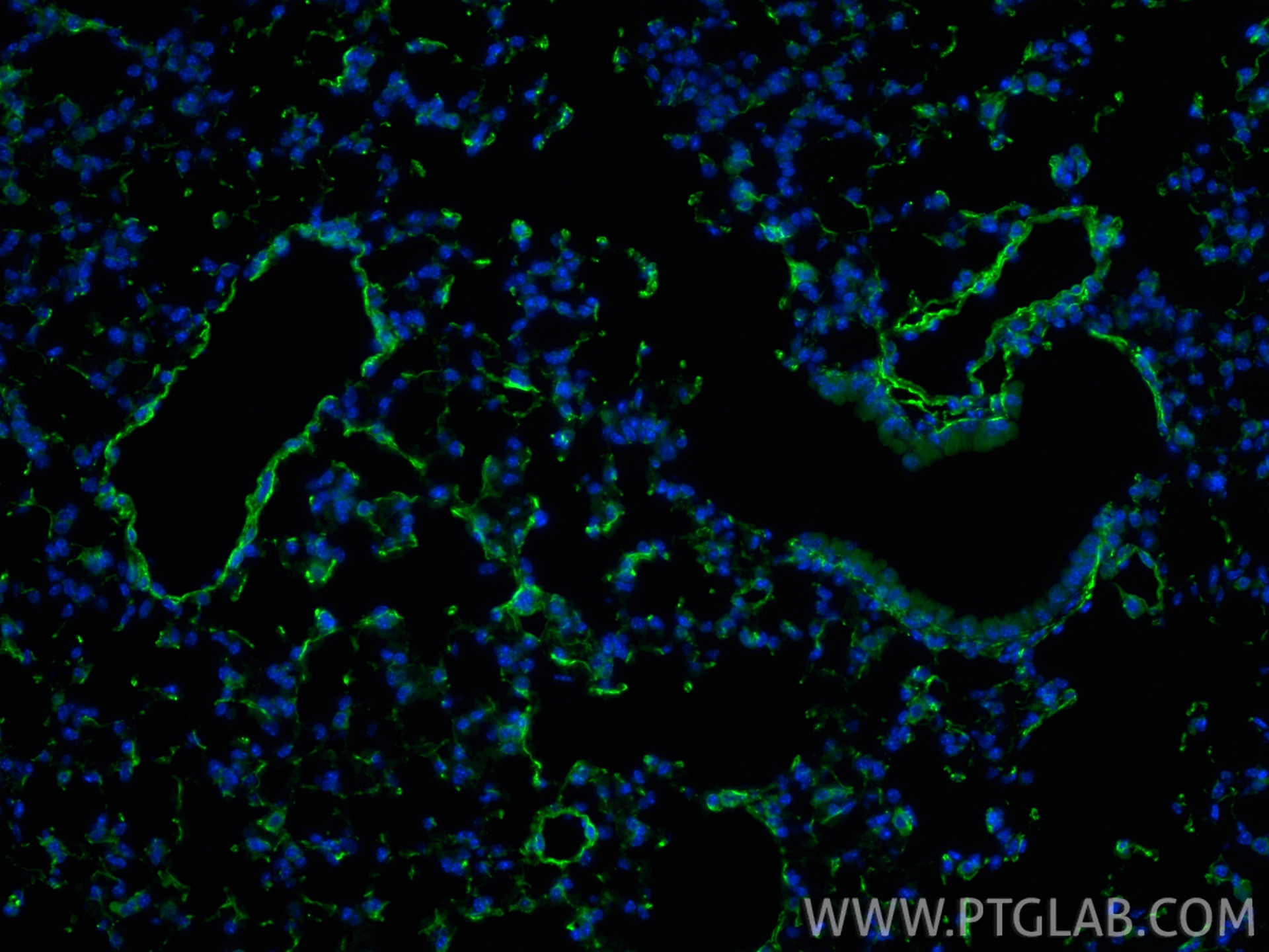 IF Staining of mouse lung using 17661-1-AP IF Staining of mouse lung using 17661-1-AP