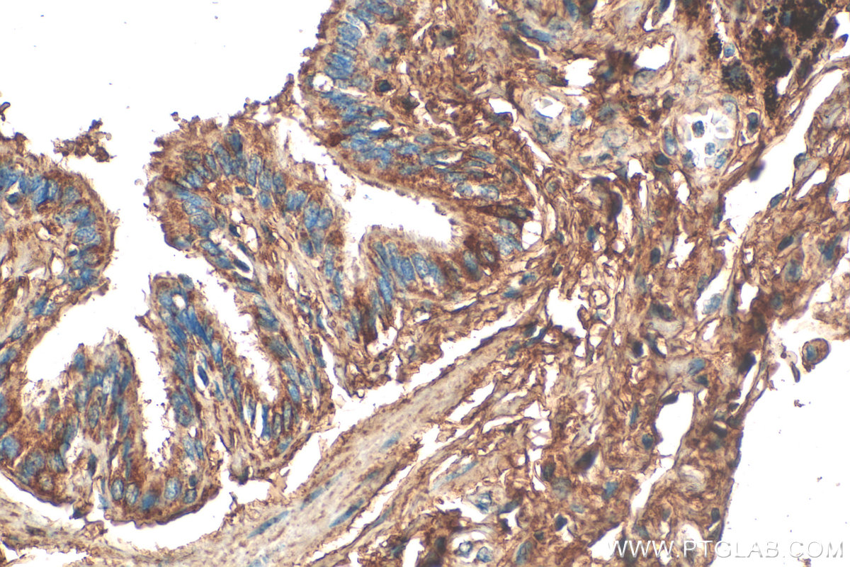 Immunohistochemical analysis of paraffin-embedded human lung tissue slide using 17661-1-AP (MFAP4 antibody) at dilution of 1:500 (under 40x lens). Heat mediated antigen retrieval with Tris-EDTA buffer (pH 9.0). IHC staining of human lung using 17661-1-AP