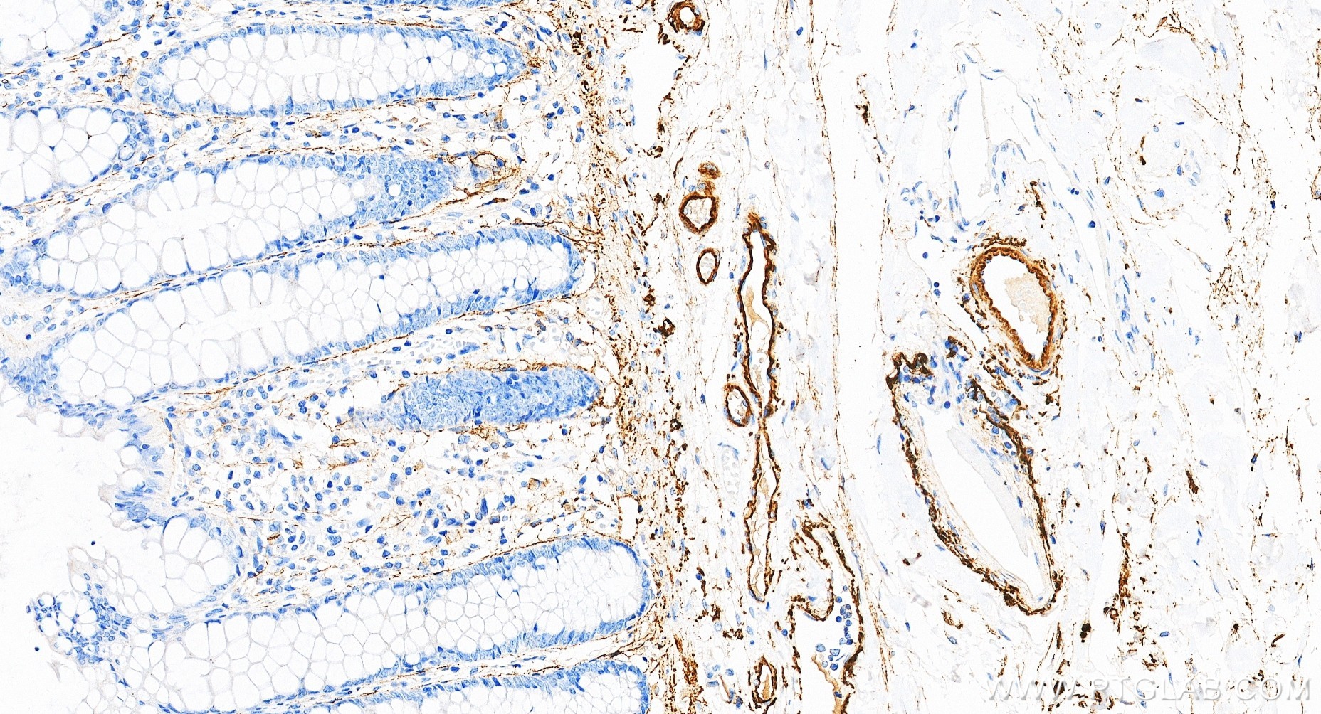 IHC staining of human colon using 88535-1-RR (same clone as 88535-1-PBS) IHC staining of human colon using 88535-1-RR (same clone as 88535-1-PBS)
