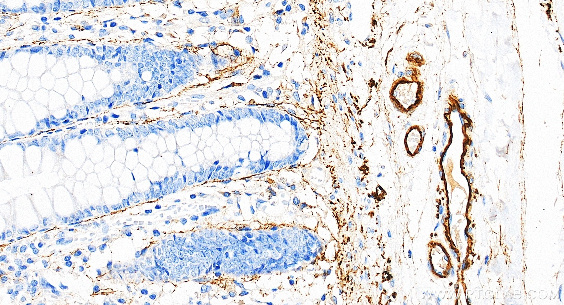 IHC staining of human colon using 88535-1-RR (same clone as 88535-1-PBS) IHC staining of human colon using 88535-1-RR (same clone as 88535-1-PBS)