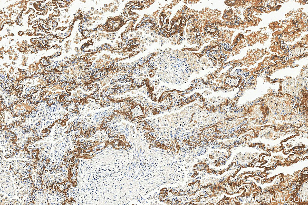 IHC staining of human lung using 88535-1-RR (same clone as 88535-1-PBS) IHC staining of human lung using 88535-1-RR (same clone as 88535-1-PBS)