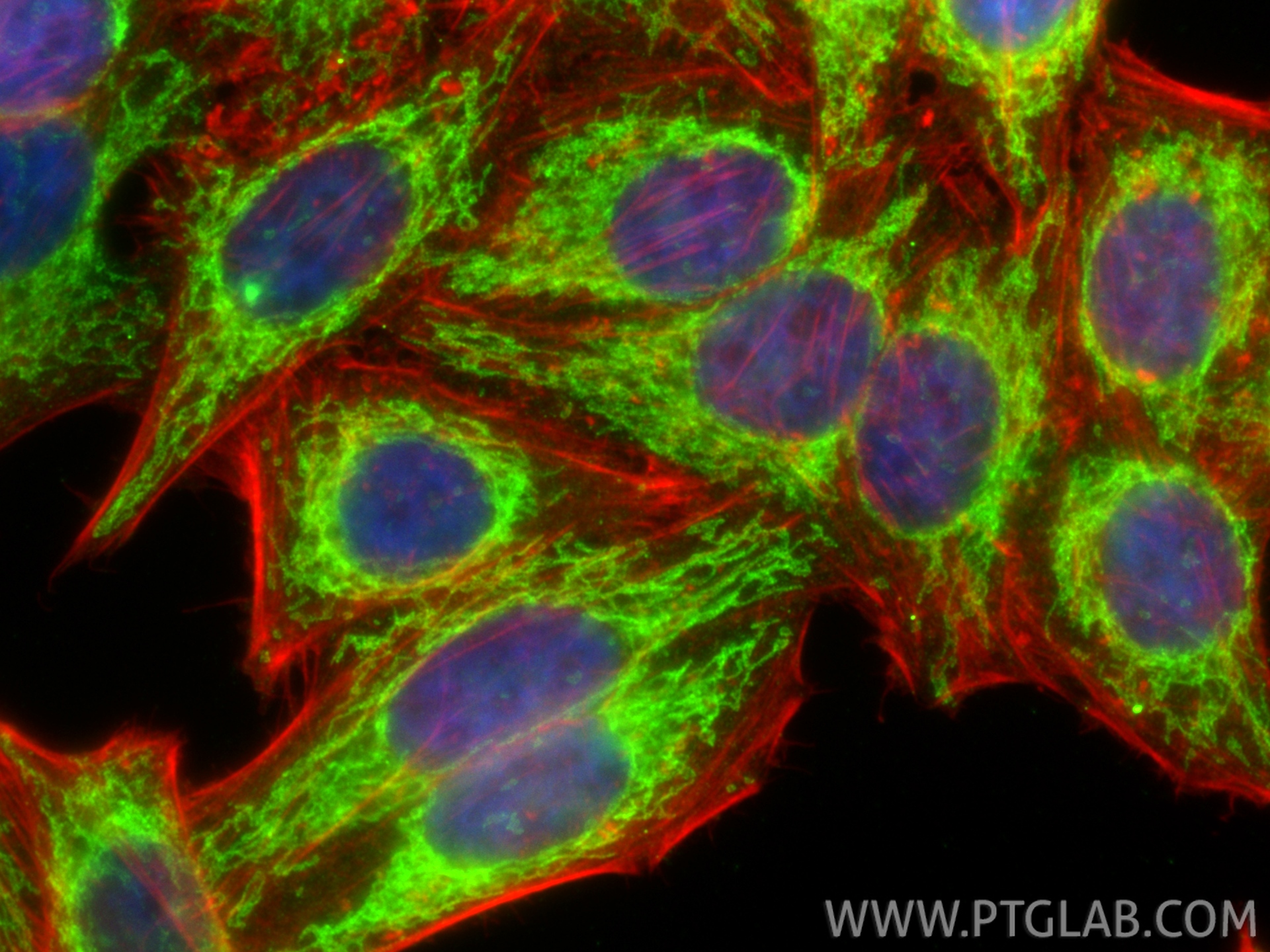 Immunofluorescent analysis of (4% PFA) fixed HepG2 cells using MFF antibody (17090-1-AP) at dilution of 1:400 and CoraLite®488-Conjugated Goat Anti-Rabbit IgG(H+L) (<a class='green' href='/productredirect?CatalogNo=SA00013-2' target='_blank'>SA00013-2</a>), CL594-phalloidin (red). IF Staining of HepG2 using 17090-1-AP