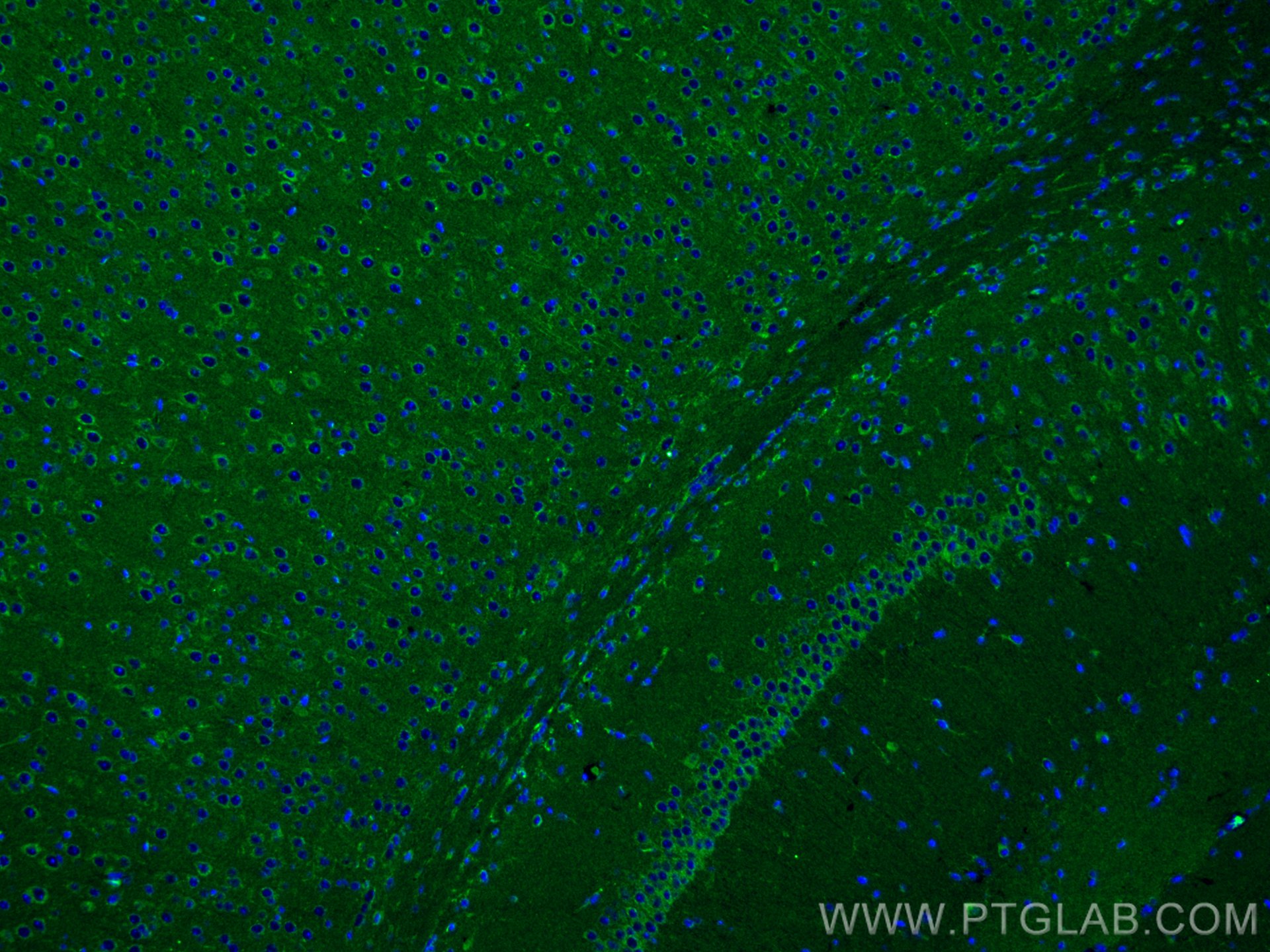 IF Staining of mouse brain using 66527-1-Ig (same clone as 66527-1-PBS)