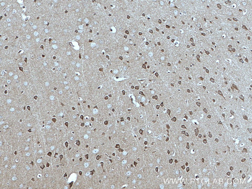 IHC staining of mouse brain using 66527-1-Ig (same clone as 66527-1-PBS)