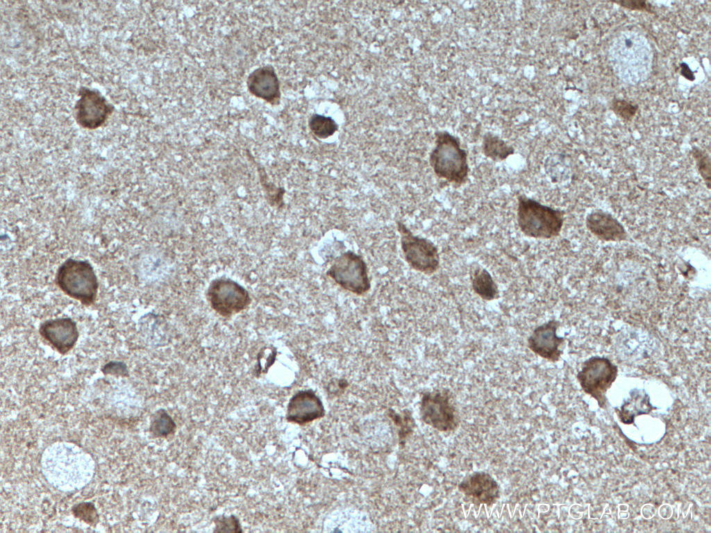 IHC staining of mouse brain using 66527-1-Ig (same clone as 66527-1-PBS)