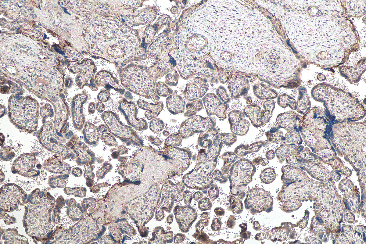 IHC staining of human placenta using 67797-1-Ig