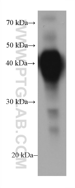 WB analysis of human milk using 67797-1-Ig