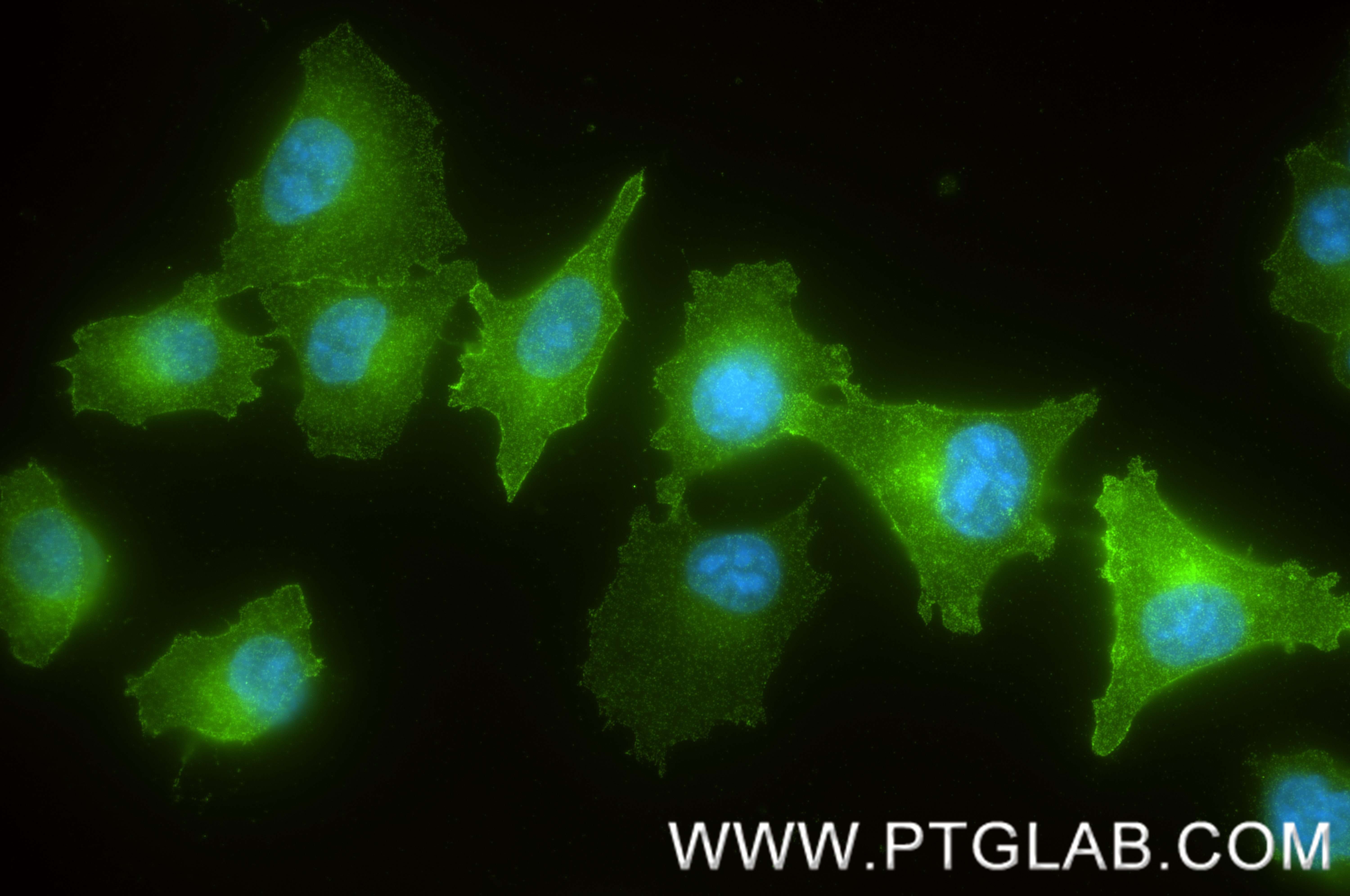 IF Staining of A375 using 88127-1-RR (same clone as 88127-1-PBS) IF Staining of A375 using 88127-1-RR (same clone as 88127-1-PBS)