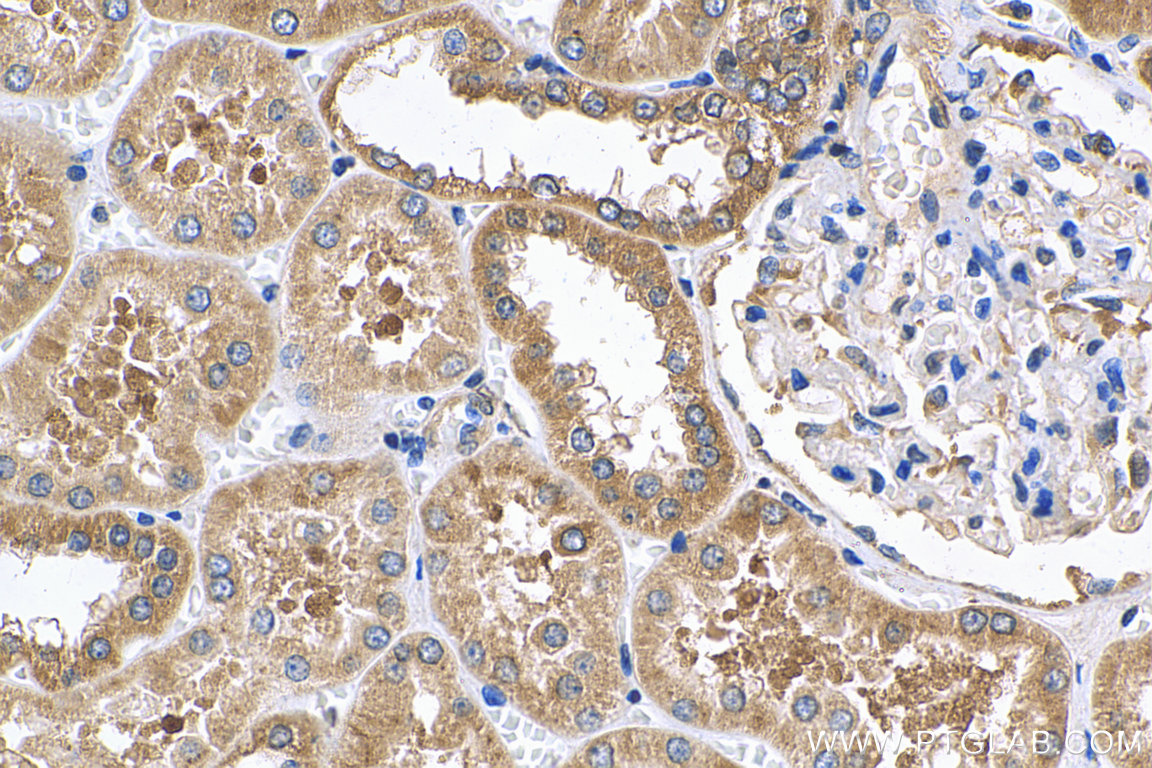 IHC staining of human kidney using 13798-1-AP