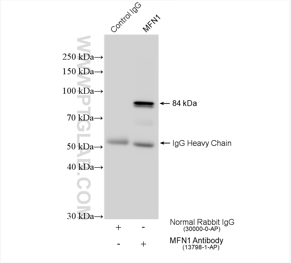 IP experiment of mouse kidney using 13798-1-AP