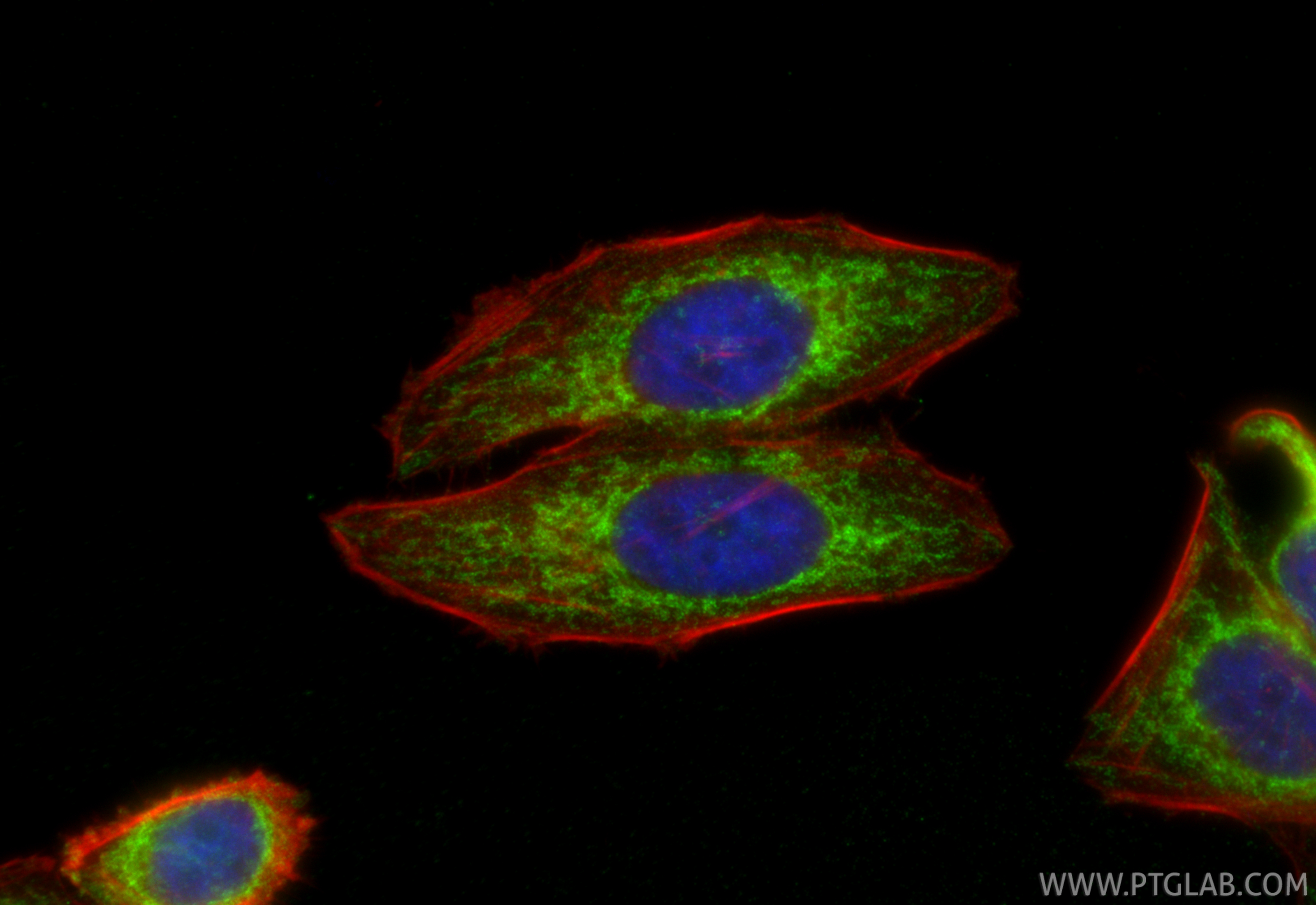 IF Staining of HepG2 using 66776-1-Ig IF Staining of HepG2 using 66776-1-Ig