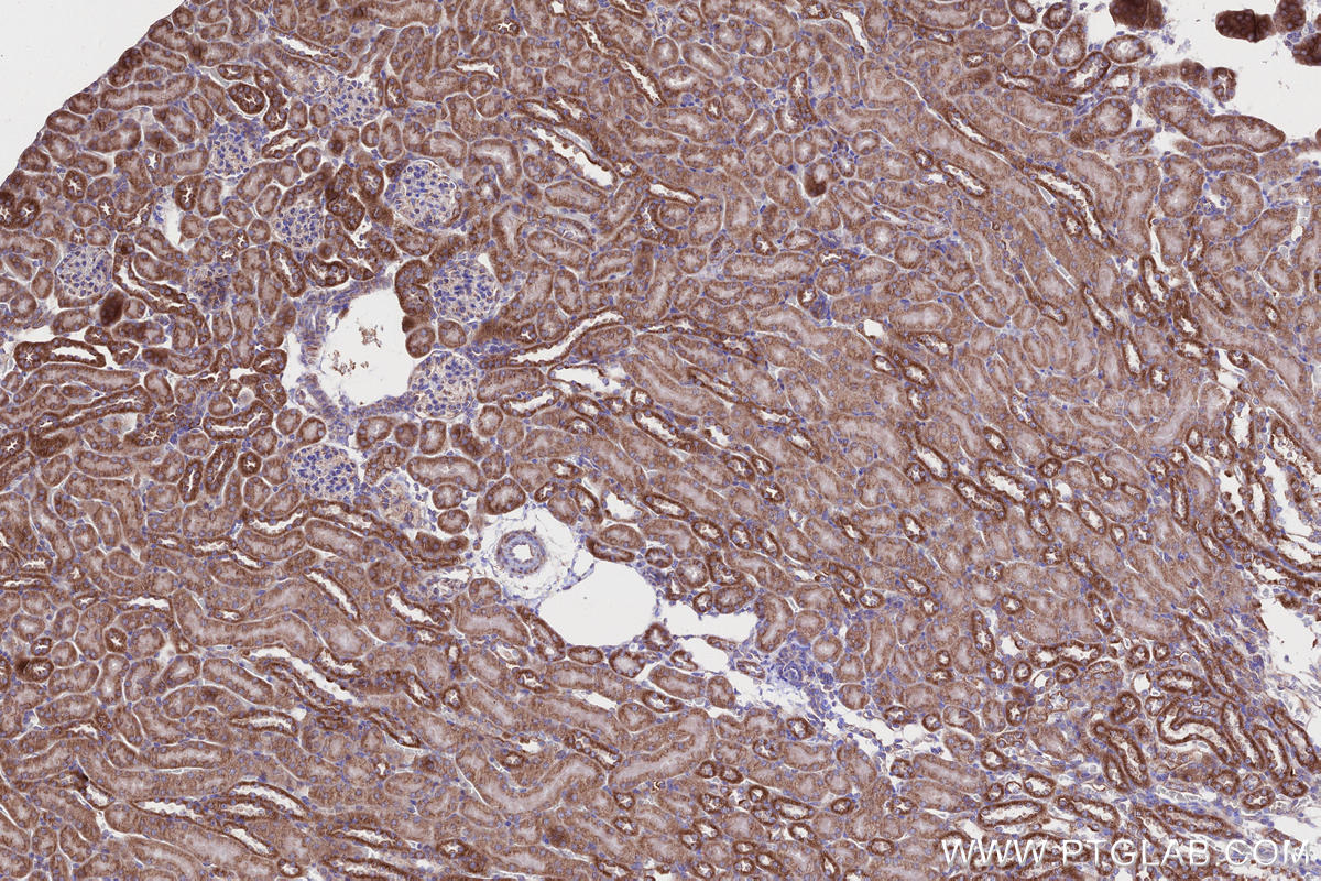 IHC staining of mouse kidney using 66776-1-Ig IHC staining of mouse kidney using 66776-1-Ig
