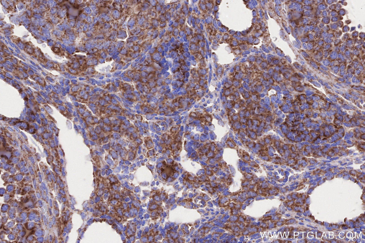 IHC staining of mouse ovary using 66776-1-Ig IHC staining of mouse ovary using 66776-1-Ig