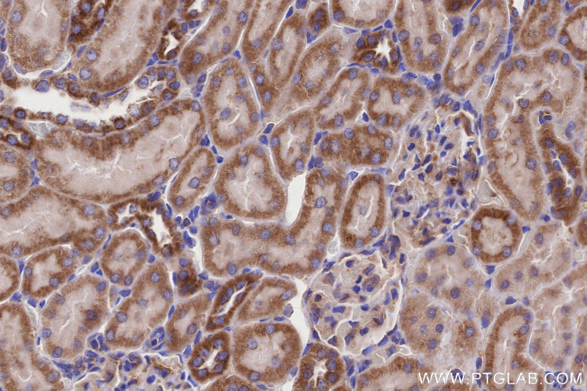 IHC staining of rat kidney using 66776-1-Ig IHC staining of rat kidney using 66776-1-Ig