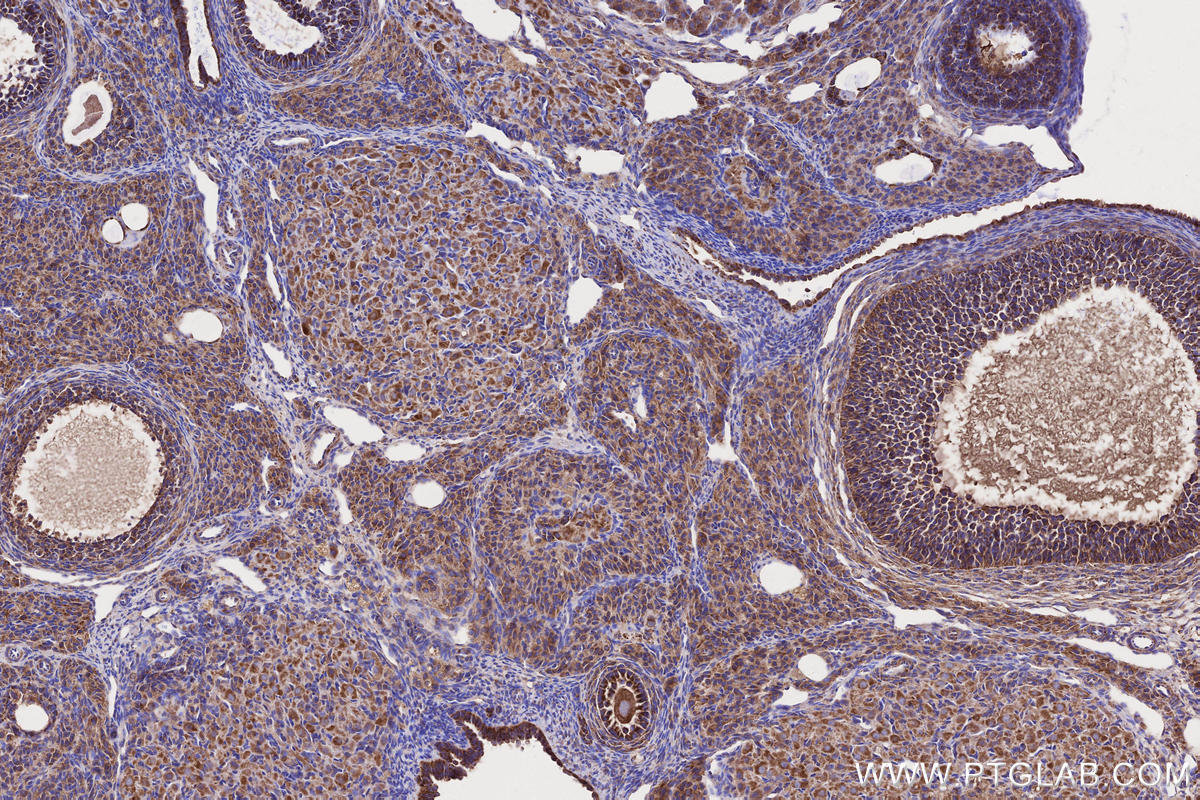 IHC staining of rat ovary using 66776-1-Ig IHC staining of rat ovary using 66776-1-Ig