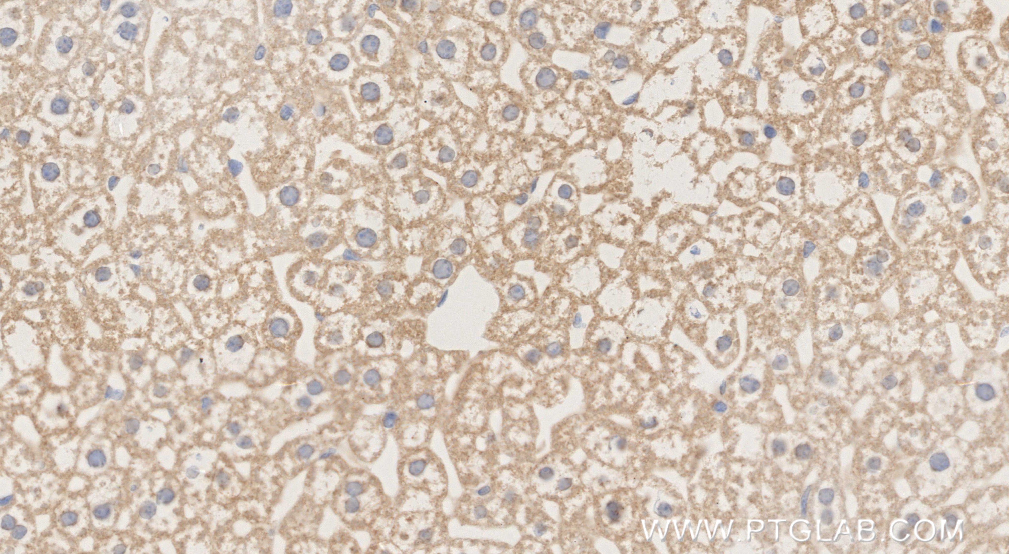 IHC staining of mouse liver using 87246-1-RR (same clone as 87246-1-PBS) IHC staining of mouse liver using 87246-1-RR (same clone as 87246-1-PBS)