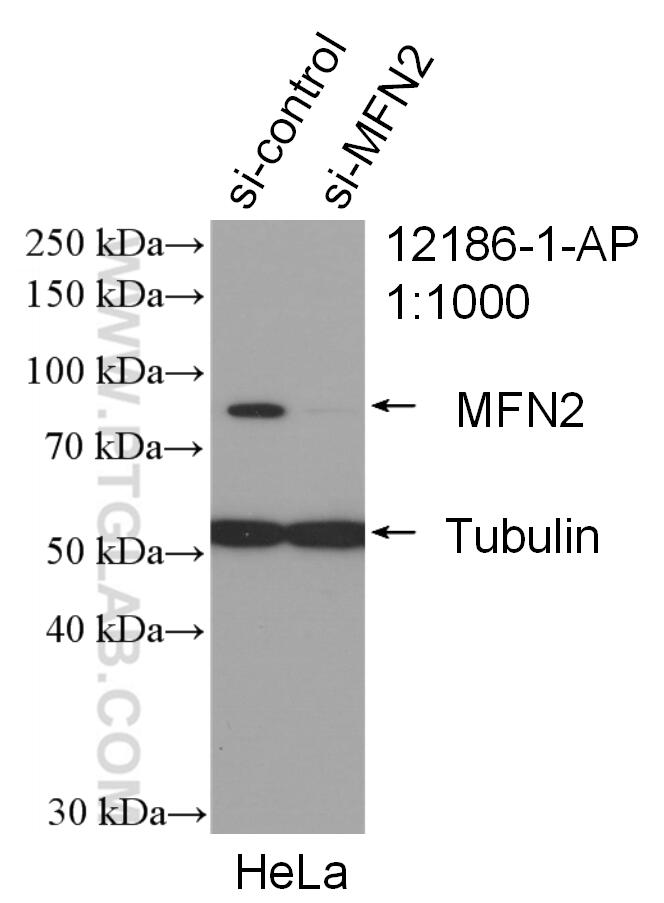 WB analysis of HeLa using 12186-1-AP