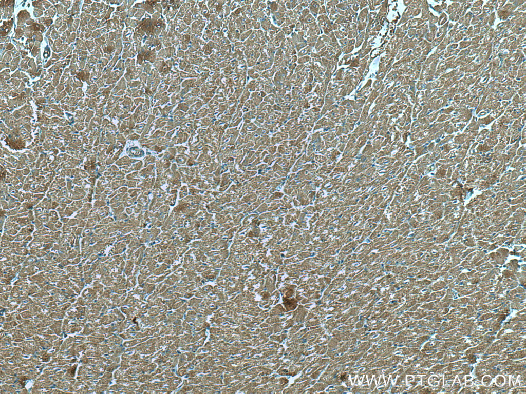 IHC staining of human heart using 67487-1-Ig (same clone as 67487-1-PBS)