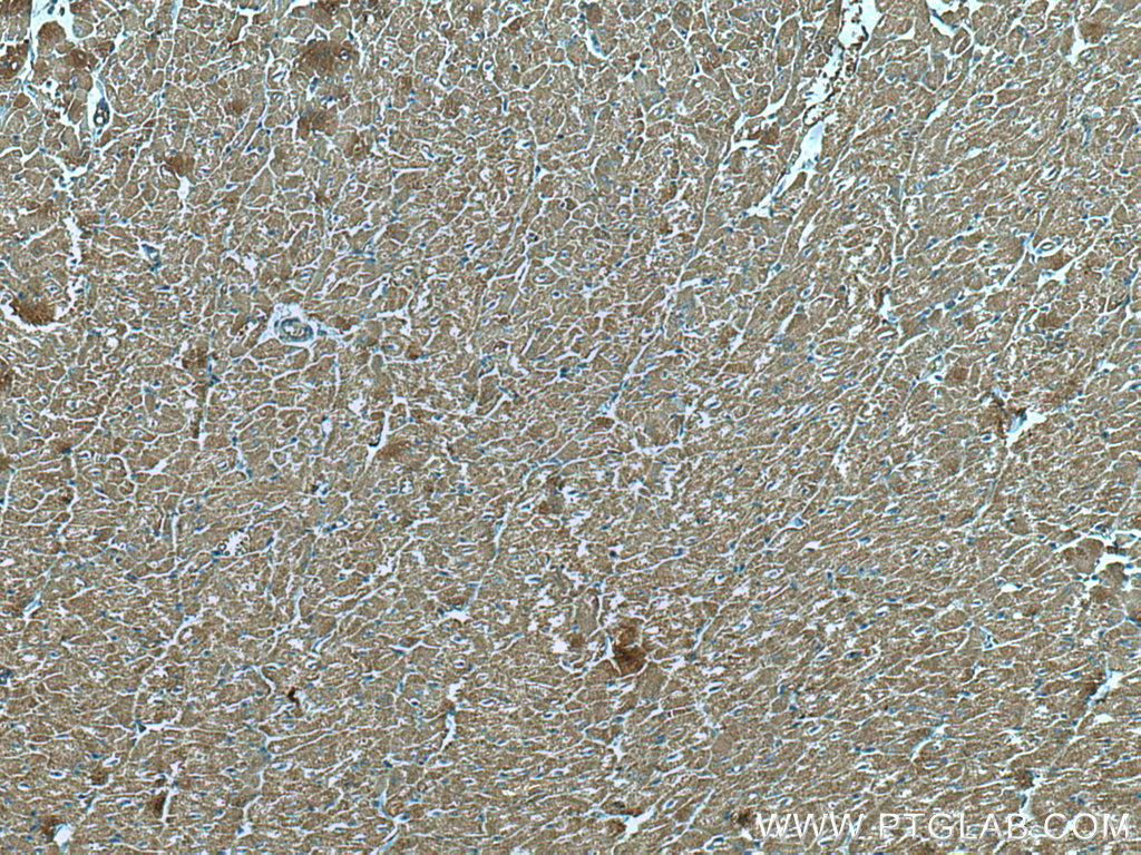 IHC staining of human heart using 67487-1-Ig