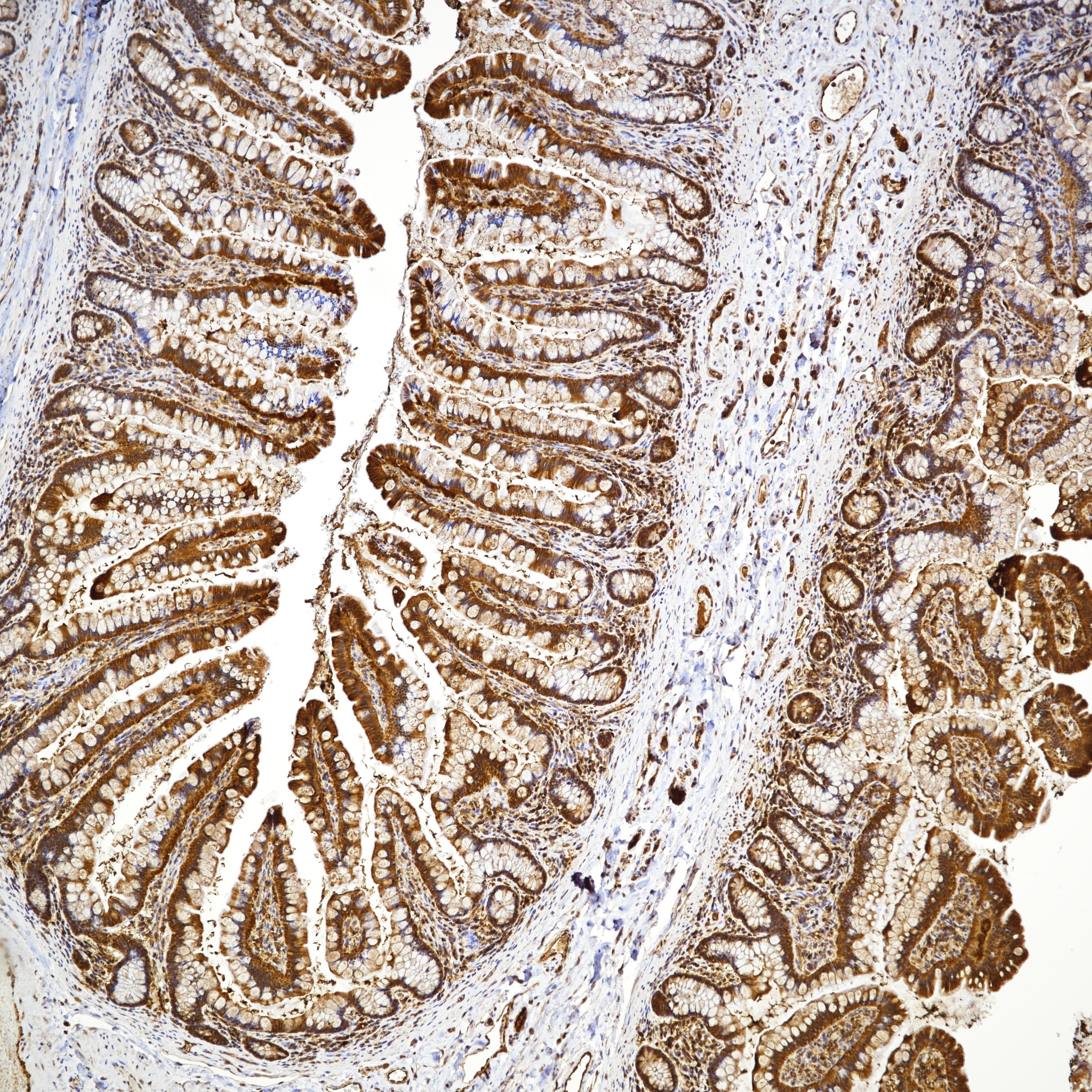 IHC staining of Human Small Bowel Tissue using 82673-2-RR IHC staining of Human Small Bowel Tissue using 82673-2-RR