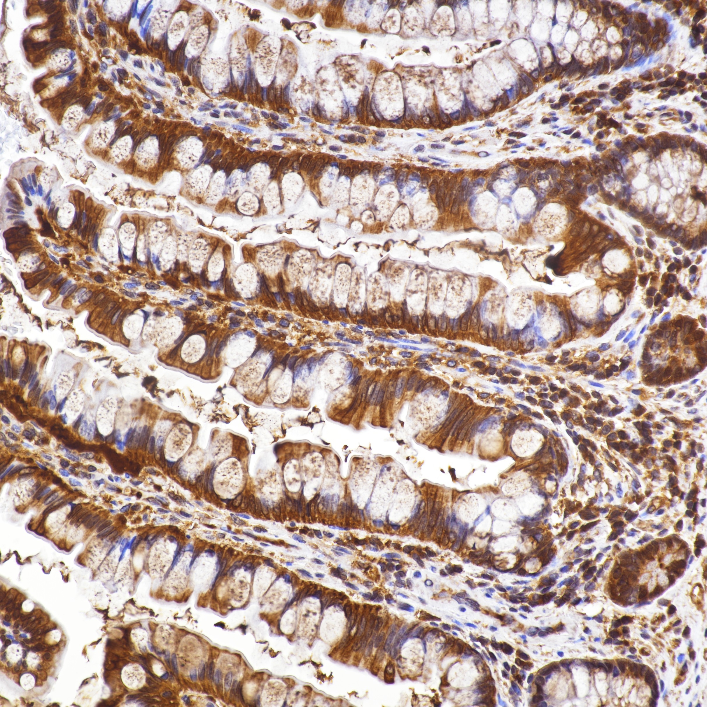 IHC staining of Human Small Bowel Tissue using 82673-2-RR IHC staining of Human Small Bowel Tissue using 82673-2-RR